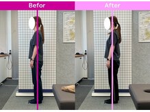 八女整体院/～姿勢改善～猫背・巻き肩