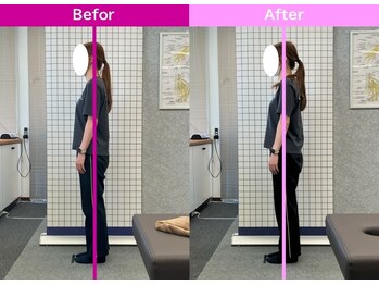 八女整体院/~姿勢改善~猫背・巻き肩