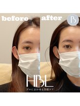 トゥルヌソル 宇都宮(tournesol)/ハリウッドブロウリフト