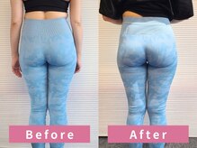 ピーチ(Peach)/ヒップアップには骨の位置が関係