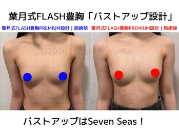 セブンシーズ 上野店(Seven Seas)/バストアップ/豊胸/東京都/上野