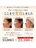 【ニキビケア特化】肌質改善コース通常￥33,000→30％OFF￥23,100