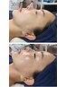 【ゆうみ指名】韓国肌管理スーパージェクションハリ、ツヤ40代以降向け