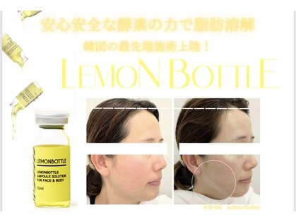 イチカエイト(ichica8)の写真