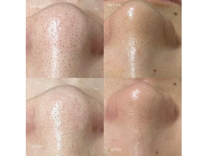 パールフェイスエステ ルペルル(PEARL FACE ESTHE la perle)の写真