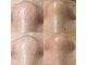 パールフェイスエステ ルペルル(PEARL FACE ESTHE la perle)の写真