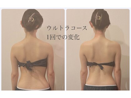 ガーレット(Garlett)の写真