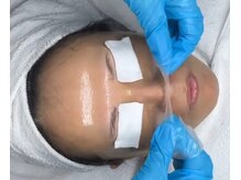 スア(SUA)/3D水光ピーリング