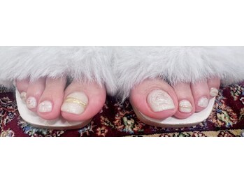 ダイアリー(Diary)/