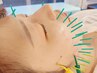【学割U24】電気を流して顔ピクピク体験◎EMSリフトアップ美容鍼 ¥8000