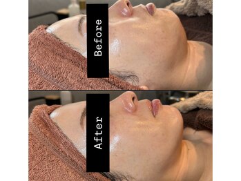 エンチャント(ENCHANT+)