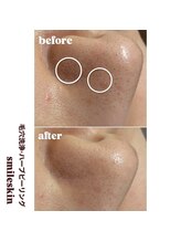 スマイルネイル(SMILE NAIL)/