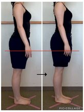 ソリ(soli)/before→after写真