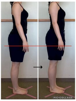 ソリ(soli)/before→after写真