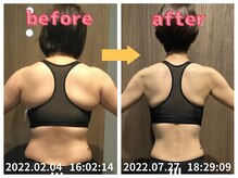 美容整体院元 光の森店/背中のハミ肉解消！