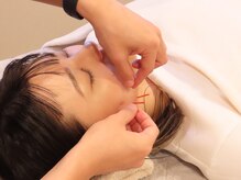 トトノエ(TOTONOE)の雰囲気（美容鍼×小顔矯正で理想の小顔に♪たるみやリフトアップに◎）