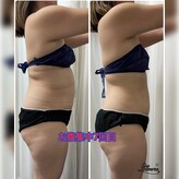 リ シェア(Re.share)