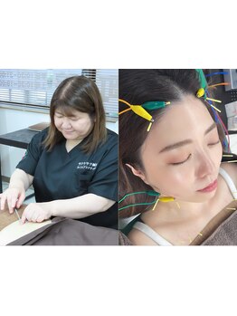 鍼灸施術を受けたい