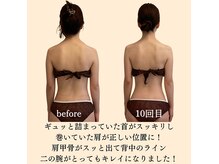 サイボウのごちそうラボ(saibouのごちそうLAB.)の雰囲気（痩せながら不調も整う◎欲張りエステ！目に見える変化を実感！）