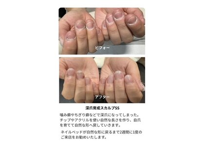 ネルネルネイル(nel nel nail)の写真