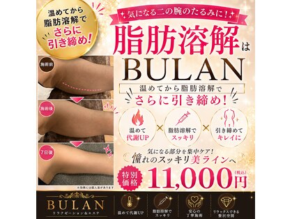 ブーラン(BULAN)の写真