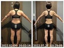 美容整体院元 光の森店/背中のたるみ改善ハミ肉改善！