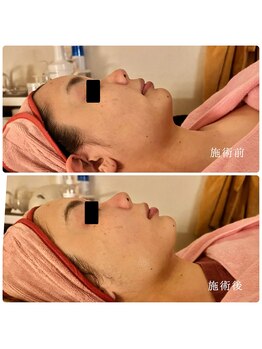 ルミナス(Luminous)/美肌＆小顔