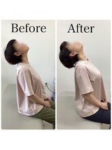 まこと整体院 新鳥栖店/ビフォーアフター　肩こり・姿勢