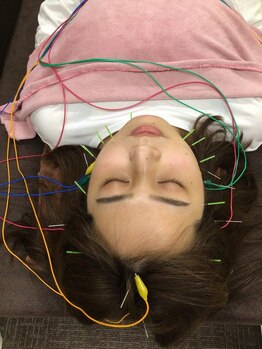 デイジー(DAISY)/美容鍼