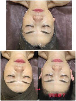 オージャス(OJAS)/50代オーナー初回 艶玉肌