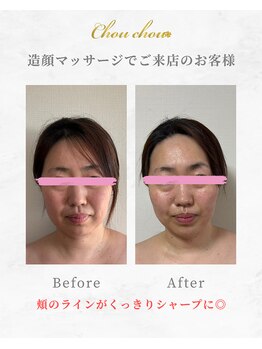 シュシュ(Chouchou)/小顔造顔マッサージ