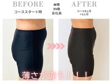 スリービーダイエット 町田店/ダイエットビフォーアフター