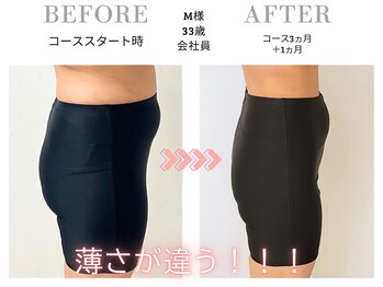 スリービーダイエット 町田店/ダイエットビフォーアフター