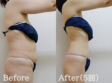 セレブリボーン 大阪ボーテの雰囲気(食事制限・辛い運動なしでこの結果。(痩身/ダイエット))