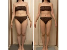 ラクシュミー/ビフォーアフター