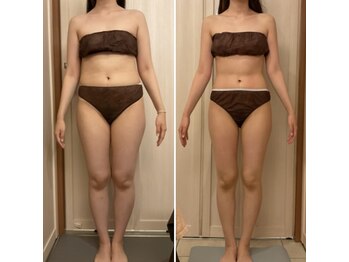 ラクシュミー/ビフォーアフター