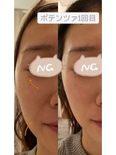 ミイン(miin)/エステ版ポテンツァ