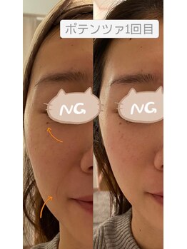 ミイン(miin)/エステ版ポテンツァ