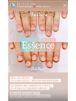 エッセンス (Essence)/深爪→ナチュラル自爪な仕上がり