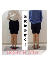 スタイルラボ高松/産後骨盤矯正の効果♪