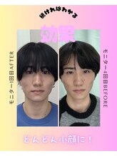 たいよう美容鍼灸院/Before After