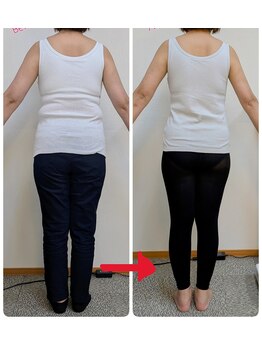 はな整体院きぶかわ院/40代、3ヶ月でうしろ姿が激変！