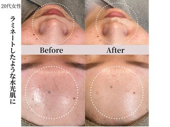 ヴィタベラ(Vita Bella)/ラミネーションピール