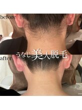 メルシートータルビューティー(MERCI)/☆うなじ美人☆