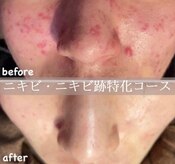 マリエンドリー