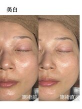 メディカルエース(MedicalAce)/前顔フォト