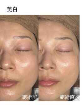 メディカルエース(MedicalAce)/前顔フォト