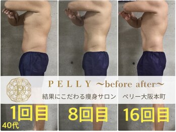 ペリー(PELLY)/男性40代　before after