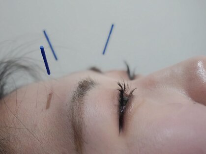 リベルタ鍼灸整骨院 なんば店(Liberta鍼灸整骨院)の写真