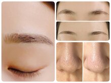 トータルビューティ ノイド(Noid)/いちご鼻撃退＋美眉毛WAX脱毛